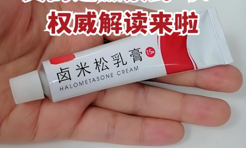 孩子身上有好多白斑网 | 孩子身上有咖啡斑是怎么造成的,孩子身上有胎记是什么原因