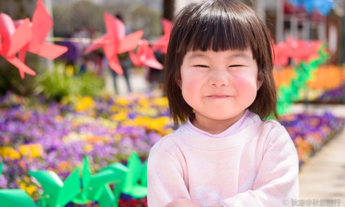 孩子身上有好多白斑网 | 孩子身上有咖啡斑是怎么造成的,孩子身上有胎记是什么原因